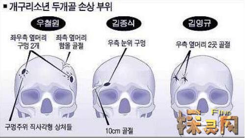 青蛙少年失踪案